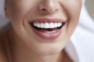 closeup smiling for cost of veneers in Greenfield  