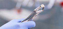 extracted tooth
