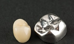 An image of a metal-free dental crown sitting next to a silver dental crown in Greenfield