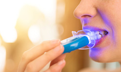 Patient in Greenfield using at-home teeth whitening