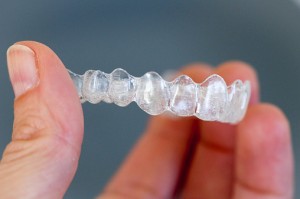 Invisalign can change your smile forever.