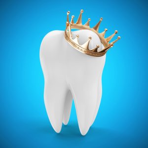 Why are CEREC one-day dental crowns superior than the traditional replacement tooth? Find out in this article with details from the team at BGH Dental. 